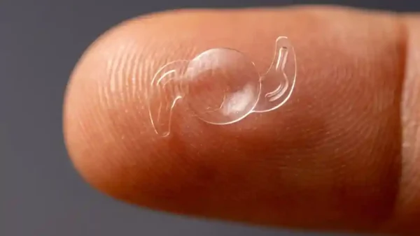 Denuncian sobreprecios en PAMI